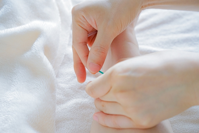 髪のように細い鍼を背中のツボにそっと施す鍼灸師の手元