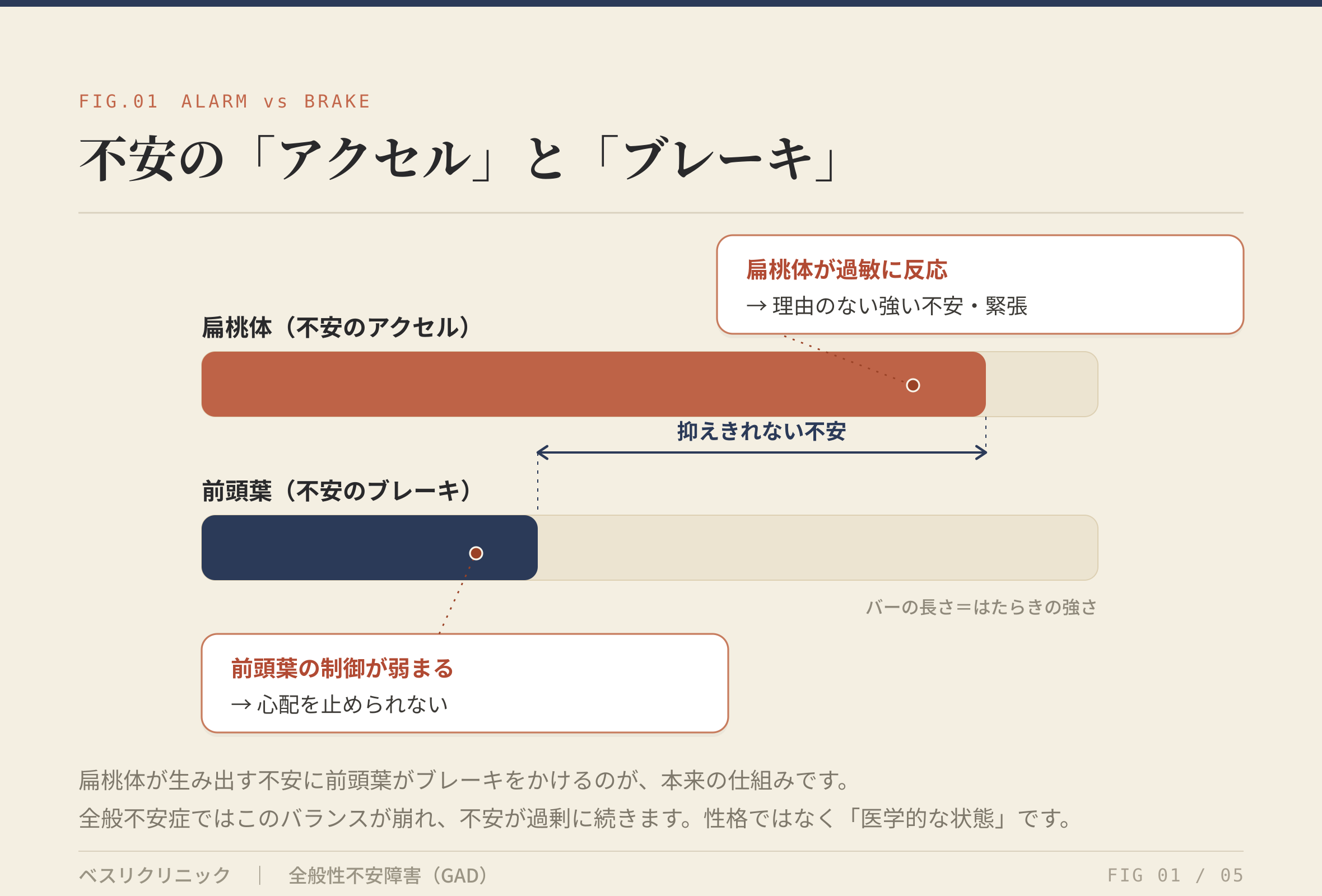 不安の「アクセル」と「ブレーキ」（扁桃体と前頭葉）
alt：全般性不安障害の脳の仕組みを示す図。不安を生み出す扁桃体を長いバー、不安を抑える前頭葉を短いバーで表し、前頭葉のブレーキが弱いと抑えきれない不安が残ることを示す。性格ではなく医学的な状態だと説明している。