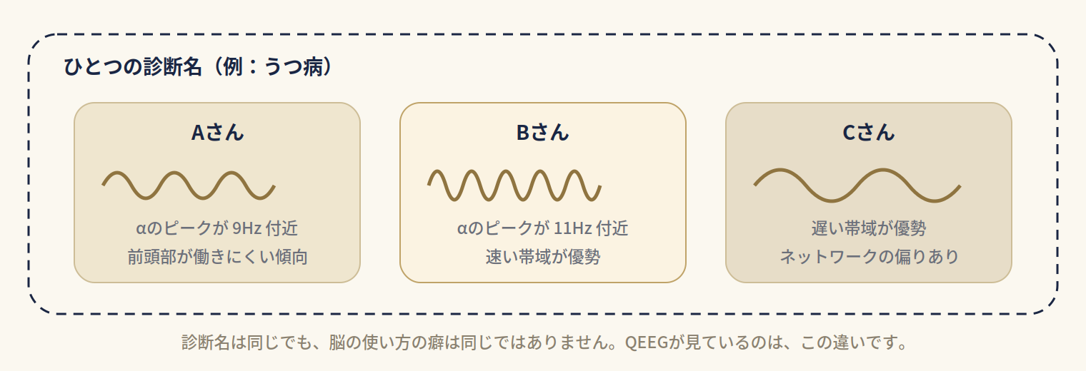同じ診断名がついた複数の人で、脳波の特徴がそれぞれ異なることを模式的に示した図。診断名は共通でも、優勢な周波数帯域や部位のバランスは人によって違うことを表している。</figure>

  </div></section>

  <section class=