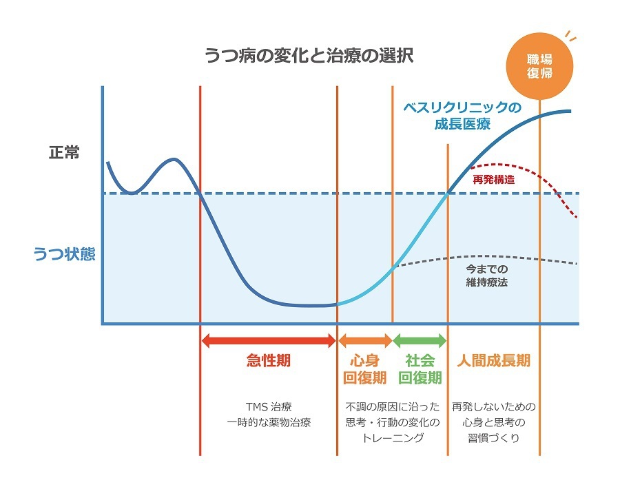 うつ病の変化と治療の選択